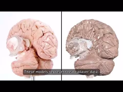 Anatomage Launches 3D-Printed Cadaver-Based Anatomy Models