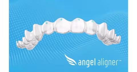 Angelalign Launches Pressure Points to Replace Torque Ridges in Europe